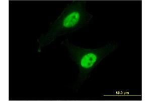 Immunofluorescence of monoclonal antibody to CAPN3 on HeLa cell. (Calpain 3 anticorps  (AA 210-309))