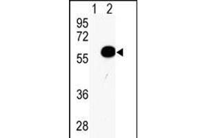 Western blot analysis of AKT2 (arrow) using rabbit polyclonal AKT2 Antibody (Center) (ABIN391023 and ABIN2841193). (AKT2 anticorps  (AA 93-123))