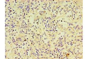 Immunohistochemistry of paraffin-embedded human spleen tissue using ABIN7174112 at dilution of 1:100 (PTPN5 anticorps  (AA 300-555))