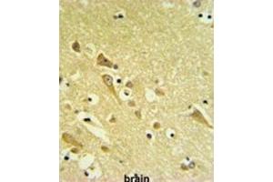 Immunohistochemistry (IHC) image for anti-Proteasomal ATPase-Associated Factor 1 (PAAF1) antibody (ABIN3002221) (PAAF1 anticorps)