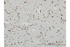 Immunoperoxidase of monoclonal antibody to RPS6KA2 on formalin-fixed paraffin-embedded human cerebral cortex.