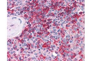 Anti-MPP5 antibody IHC of human spleen.