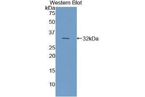 Detection of Recombinant CYP7A1, Mouse using Polyclonal Antibody to Cytochrome P450 7A1 (CYP7A1) (CYP7A1 anticorps  (AA 227-467))