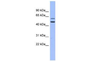 WB Suggested Anti-DKC1 Antibody Titration:  0. (DKC1 anticorps  (N-Term))