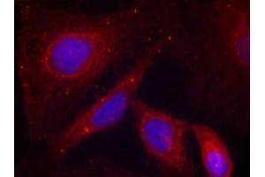 Immunofluorescence staining of methanol-fixed Hela cells using PAK1(Phospho-Thr212) Antibody. (PAK1 anticorps  (pThr212))