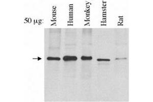 Western blot analysis of TRF1 using TERF1 monoclonal antibody, clone 57-6 . (TRF1 anticorps)