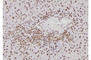 ABIN6276797 at 1/100 staining Mouse liver tissue by IHC-P.