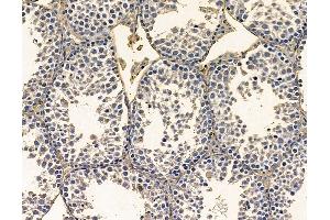 ABIN7097093 and ABIN7101160 at 1/100 staining mouse testis tissue by IHC-P.