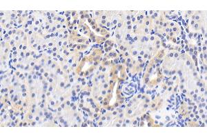 Detection of Hsp60 in Human Kidney Tissue using Polyclonal Antibody to Heat Shock Protein 60 (Hsp60)