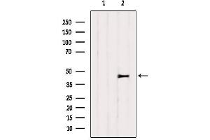 Western blot analysis of extracts from 3T3, using SERPINH1 Antibody. (SERPINH1 anticorps  (Internal Region))