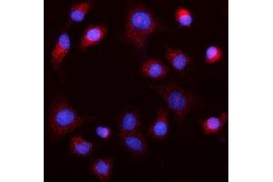 IF analysis of MEK5/MAP2K5 using anti-MEK5/MAP2K5 antibody (ABIN7601657).