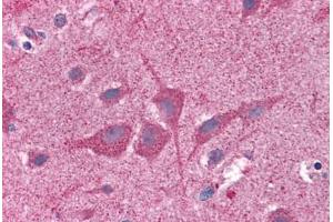 Human Brain, Cortex: Formalin-Fixed, Paraffin-Embedded (FFPE)