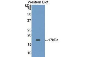 Western Blotting (WB) image for anti-CD3d Molecule, delta (CD3-TCR Complex) (CD3D) (AA 18-113) antibody (ABIN3205929) (CD3D anticorps  (AA 18-113))