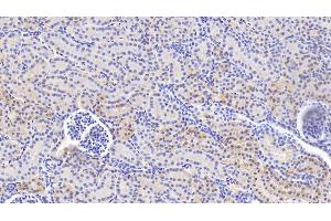 Detection of VCL in Human Kidney Tissue using Anti-Vinculin (VCL) Polyclonal Antibody (Vinculin anticorps  (AA 1020-1134))