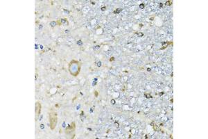 Immunohistochemistry of paraffin-embedded mouse spinal cord using DARS antibody (ABIN5973949) at dilution of 1/100 (40x lens). (DARS anticorps)