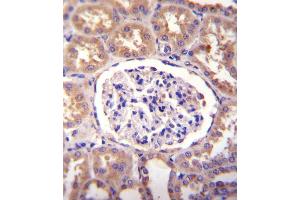 SLCO4C1 Antibody immunohistochemistry analysis in formalin fixed and paraffin embedded human kidney tissue followed by peroxidase conjugation of the secondary antibody and DAB staining.