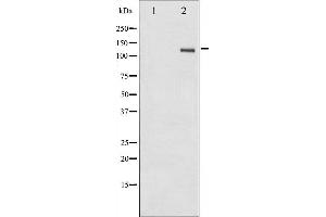 Western blot analysis of FAK phosphorylation expression in HepG2 whole cell lysates,The lane on the left is treated with the antigen-specific peptide.
