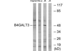 Western Blotting (WB) image for anti-UDP-Gal:betaGlcNAc beta 1,4- Galactosyltransferase, Polypeptide 3 (B4GALT3) (Internal Region) antibody (ABIN5977439) (B4GALT3 anticorps  (Internal Region))