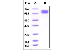 Mouse M-CSF R, His Tag on SDS-PAGE under reducing (R) condition. (CSF1R Protein (AA 20-511) (His tag))
