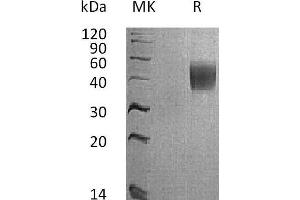 Western Blotting (WB) image for Interleukin 4 Receptor (IL4R) (Active) protein (His tag) (ABIN7320981)