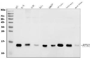 Western blot analysis of Profilin 2/PFN2 using anti-Profilin 2/PFN2 antibody (ABIN7602692).