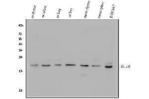 Western blot analysis of IL18 using anti-IL18 antibody (ABIN7601462).