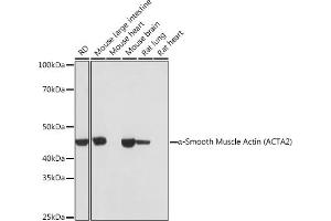 Western blot analysis of extracts of various cell lines, using α-Smooth Muscle Actin  antibody (ABIN7265392) at 1:1000 dilution. (Smooth Muscle Actin anticorps)