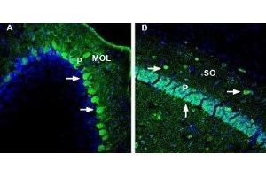 Expression of DPP10 in mouse cerebellum and hippocampus - Immunohistochemical staining of perfusion-fixed frozen mouse brain sections with Anti-DPP10 (extracellular) Antibody (ABIN7043099, ABIN7045044 and ABIN7045045), (1:1000), followed by goat anti-rabbit-AlexaFluor-488.