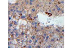 Used in DAB staining on fromalin fixed paraffin-embedded liver tissue (LDLR anticorps  (AA 263-509))