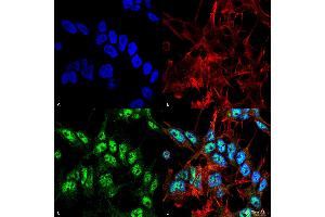 Immunocytochemistry/Immunofluorescence analysis using Rabbit Anti-Beclin 1 Polyclonal Antibody . (Beclin 1 anticorps  (FITC))