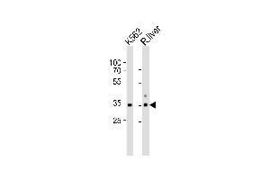 Western blot analysis of lysates from K562 cell line and rat liver tissue lysate(from left to right), using ATP1B2 Antibody (Center) (ABIN653219 and ABIN2842755).