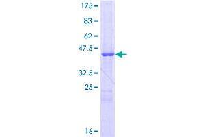 Image no. 1 for CSE1 Chromosome Segregation 1-Like (CSE1L) (AA 1-195) protein (GST tag) (ABIN1350486)