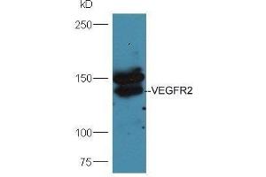 Mouse lung lysates probed with Anti-VEGFR2 Polyclonal Antibody  at 1:5000 90min in 37˚C. (VEGFR2/CD309 anticorps  (AA 101-200))