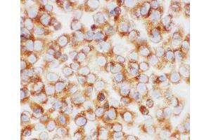 Anti-Collagen I antibody, ICC: NIH3T3 Cell