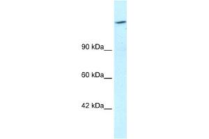 WB Suggested Anti-ARID4A Antibody Titration:  1. (ARID4A anticorps  (C-Term))