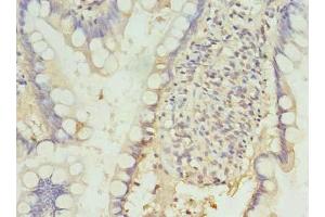 Immunohistochemistry of paraffin-embedded human small intestine tissue using ABIN7164683 at dilution of 1:100 (PD-1 anticorps  (AA 21-170))