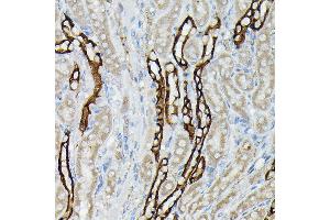Immunohistochemistry of paraffin-embedded mouse kidney using  Rabbit pAb (ABIN3016811, ABIN3016812, ABIN3016813, ABIN1678723 and ABIN6219847) at dilution of 1:50 (40x lens). (AQP3 anticorps  (AA 178-292))