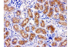 Anti- CYP24A1 Picoband antibody, IHC(P) IHC(P): Rat Kidney Tissue