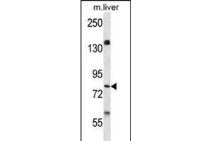 KI Antibody  (ABIN652432 and ABIN2842239) western blot analysis in mouse liver tissue lysates (35 μg/lane). (BRSK1 anticorps  (C-Term))