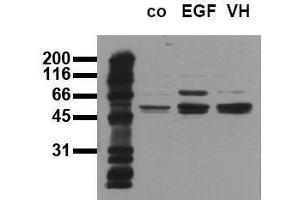 Western Blotting (WB) image for anti-SHC (Src Homology 2 Domain Containing) Transforming Protein 1 (SHC1) (pTyr317) antibody (ABIN126889) (SHC1 anticorps  (pTyr317))