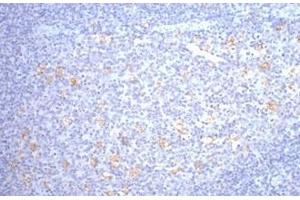 Immunohistochemistry of paraffin-embedded Human tonsil tissue using CD68 Monoclonal Antibody at dilution of 1:200.