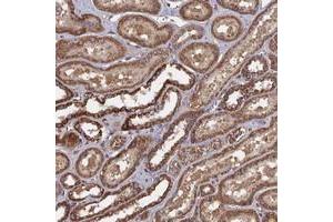 Immunohistochemical staining of human kidney with SPANXN4 polyclonal antibody  shows strong cytoplasmic positivity in cells of tubules at 1:10-1:20 dilution. (SPANXN4 anticorps)