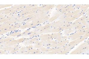 Detection of HIF1a in Human Cardiac Muscle Tissue using Monoclonal Antibody to Hypoxia Inducible Factor 1 Alpha (HIF1a)
