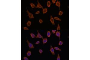 Immunofluorescence analysis of L929 cells using TMED2 antibody (ABIN7270943) at dilution of 1:100.