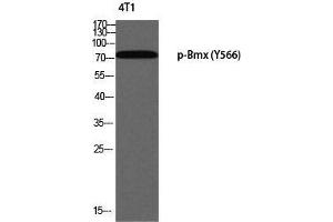 Western Blot (WB) analysis of 4T1 using p-Bmx (Y566) antibody. (BMX anticorps  (pTyr566))