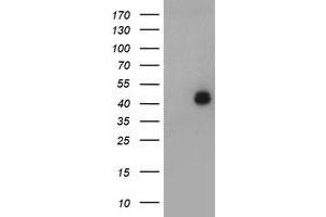 Image no. 1 for anti-LIM Homeobox 1 (LHX1) (AA 100-362) antibody (ABIN1490807) (LHX1 anticorps  (AA 100-362))