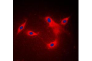 Immunofluorescent analysis of LYPLA1 staining in MDAMB453 cells. (LYPLA1 anticorps  (Center))