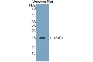 Western blot analysis of the recombinant protein. (TMEM27 anticorps  (AA 15-141))