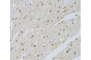 Immunohistochemistry of paraffin-embedded Rat heart using SNRPA Polyclonal Antibody at dilution of 1:100 (40x lens). (SNRPA1 anticorps)