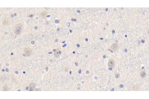 Detection of CYPA in Human Cerebrum Tissue using Polyclonal Antibody to Cyclophilin A (CYPA)